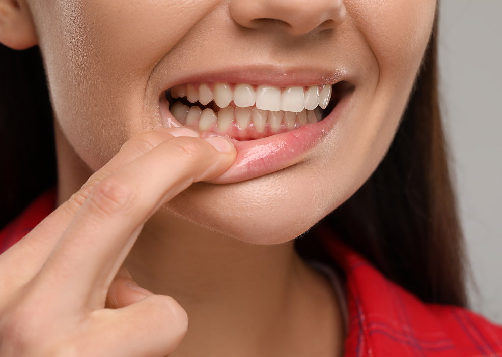 Periodontal Therapy