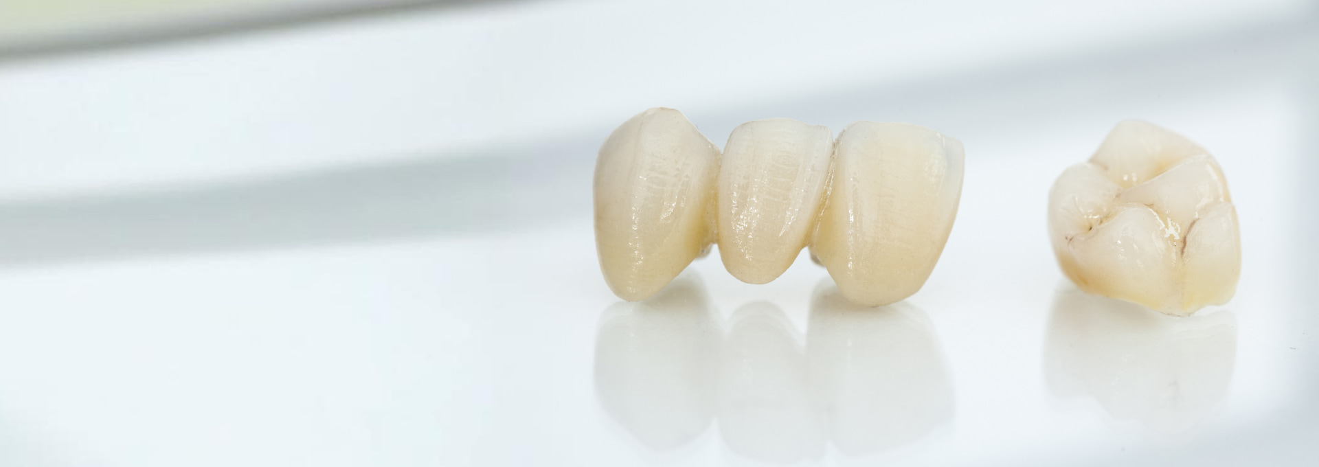 Dental Bridges Banner Image